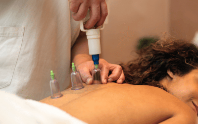 myofascial cupping